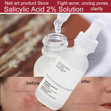 Ordinary Face Serum 10-Minute Exfoliating Face  AHA 30%+ BHA 2% Peeling Solution 30ml Blemishes Remove Acne Scars Whitening