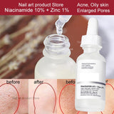 Ordinary Face Serum 10-Minute Exfoliating Face  AHA 30%+ BHA 2% Peeling Solution 30ml Blemishes Remove Acne Scars Whitening